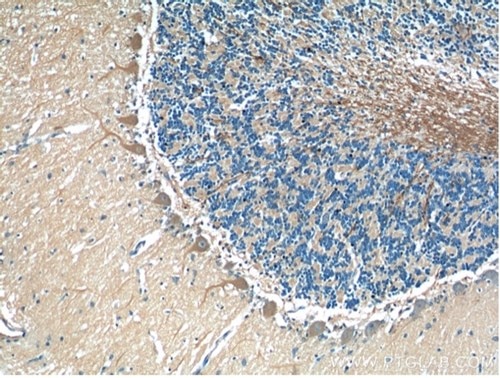 IHC of human cerebellum tissue stained with TMEM106B antibody from proteintech (60333-1-Ig)