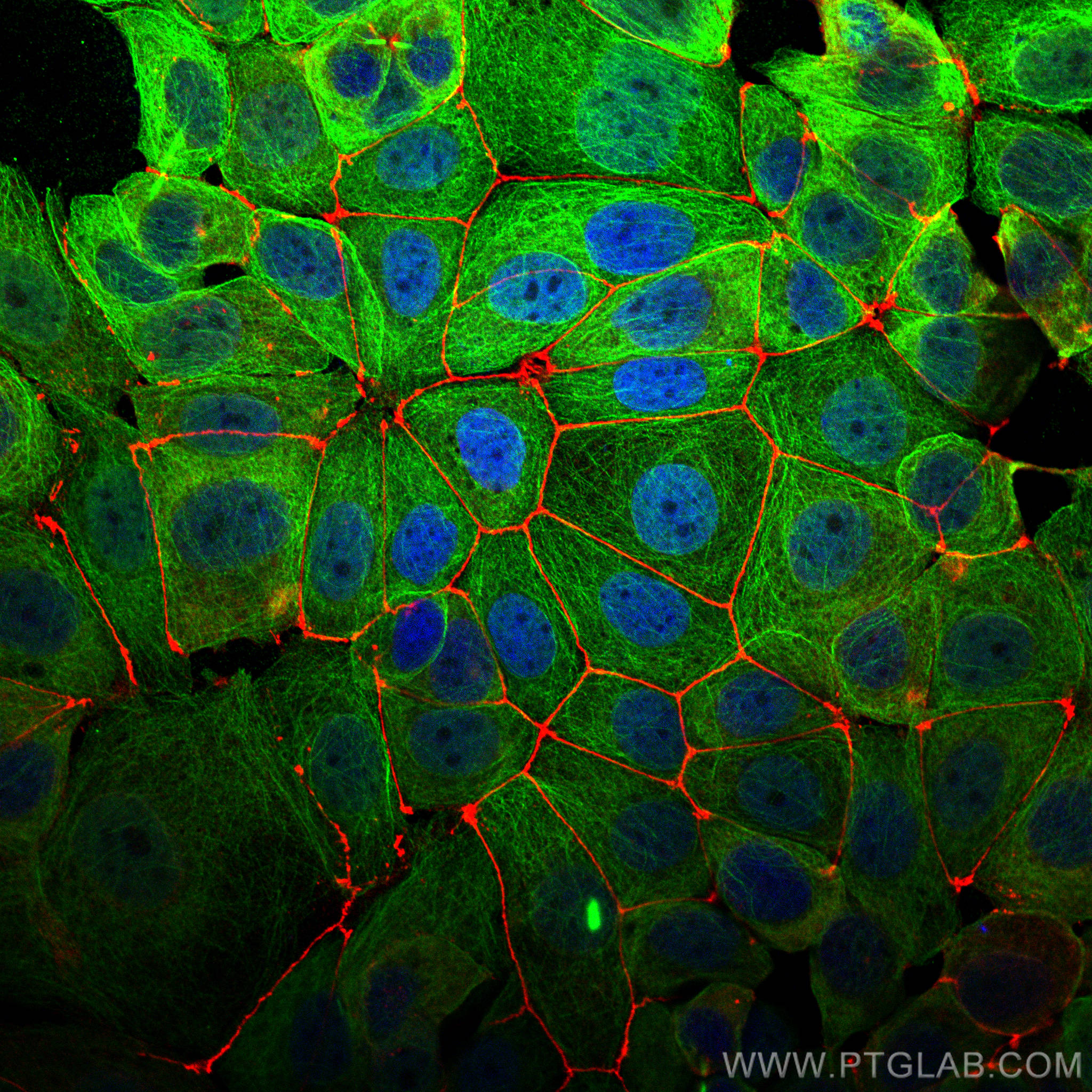 Immunofluorescence (IF) analysis of MCF-7 cells stained with rabbit anti-ZO1 polyclonal antibody (21773-1-AP, red) and mouse anti-Alpha Tubulin monoclonal antibody (66031-1-Ig, green). Multi-rAb CoraLite® Plus 594-Goat Anti-Rabbit Recombinant Secondary Antibody (H+L) (RGAR004, 1:500) and Multi-rAb CoraLite® Plus 488-Goat Anti-Mouse Recombinant Secondary Antibody (H+L)(RGAM002, 1:500) were used for detection.  