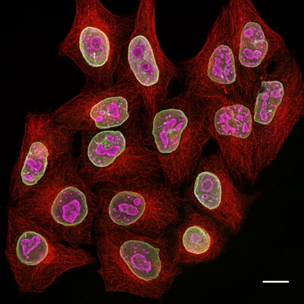 Multiplexed immunostaining of HeLa cells with two alpaca anti-mouse Nano-Secondaries and one conventional secondary antibody