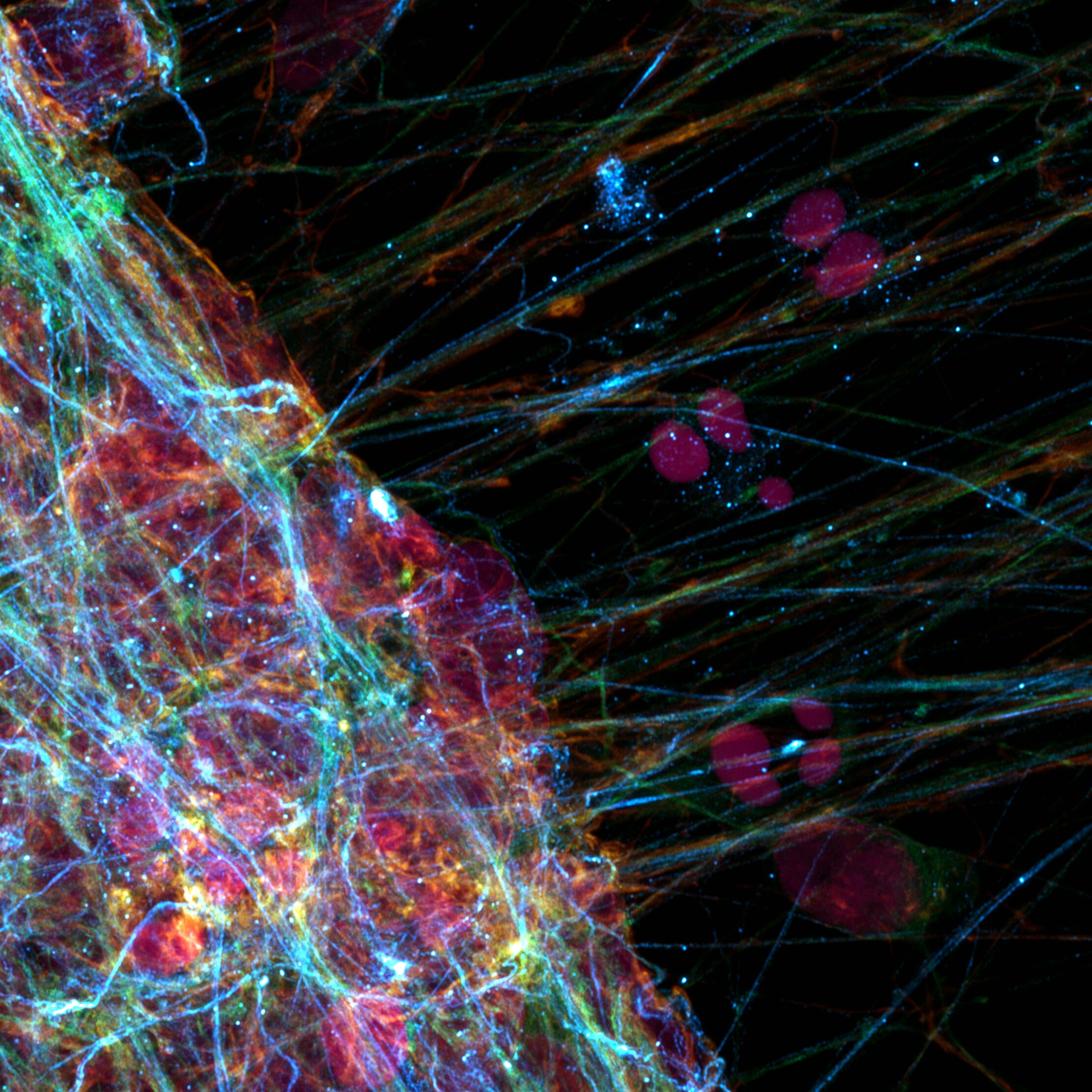 This image displays a vibrant microscopic view of fluorescently stained neurons. Bright colors illustrate the complex network of neural connections, with threads and cell bodies prominently visible.