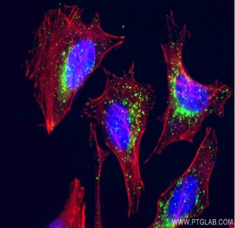 organelle markers lysosome and autophagosome markers