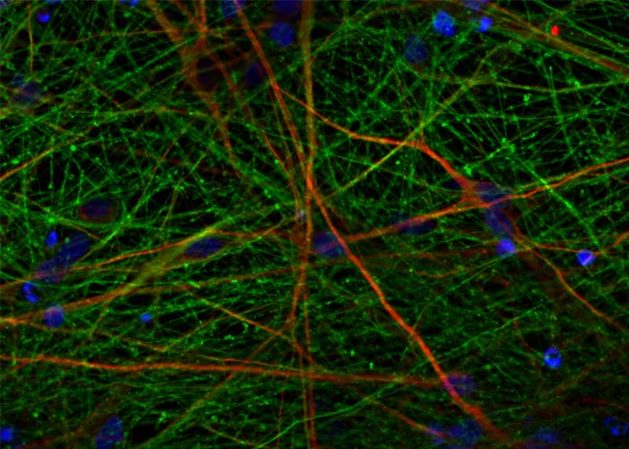 Neural stem / neural progenitor cell (NSC/NPC) markers Proteintech Group