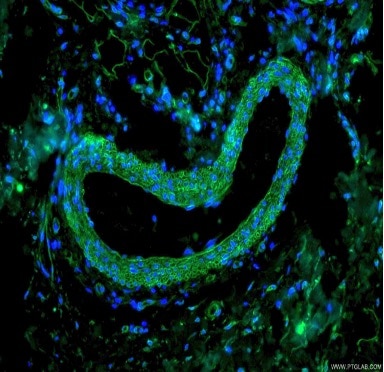 organelle markers caveolae markers