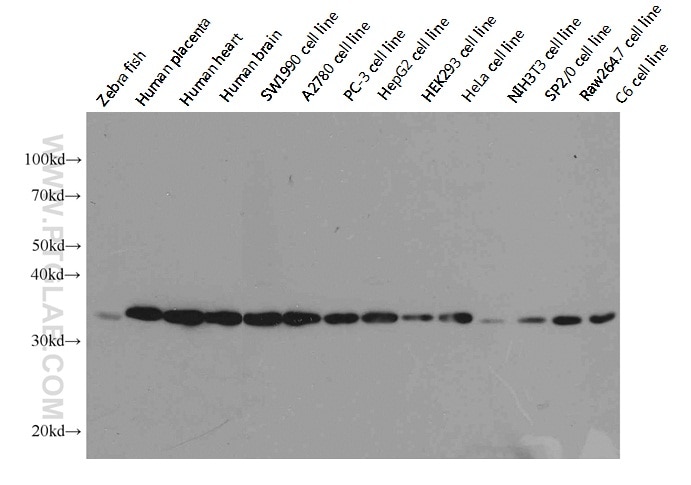 Western blot image with multiple lanes and a single prominent band across the gel