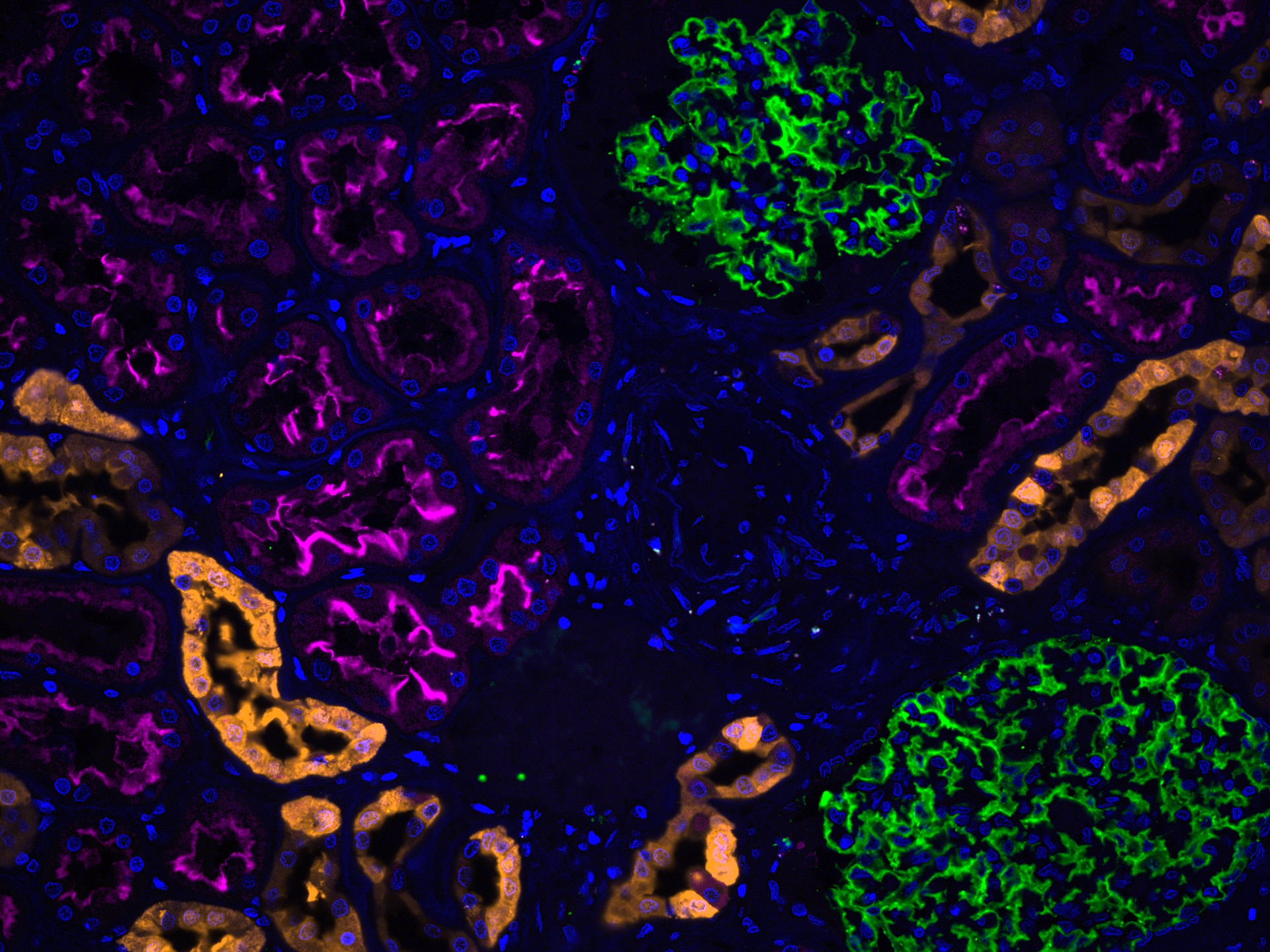 Immunofluorescence of human kidney: FFPE human kidney sections were stained with anti-Calbindin antibody (14479-1-AP) labeled with FlexAble CoraLite® Plus 555 Kit (KFA002, yellow), anti-ACE2 antibody (66699-1-Ig) labeled with FlexAble CoraLite® Plus 647 Kit (KFA023, magenta), CoraLite®488-conjugated Podocalyxin antibody (CL488-18150, green) and DAPI (blue).