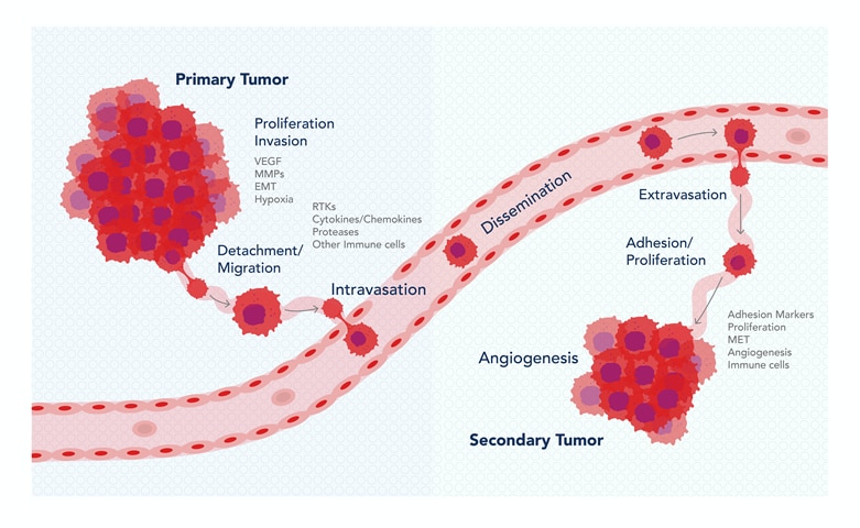 Diagram of the metastatic cascade and the markers associated with each step