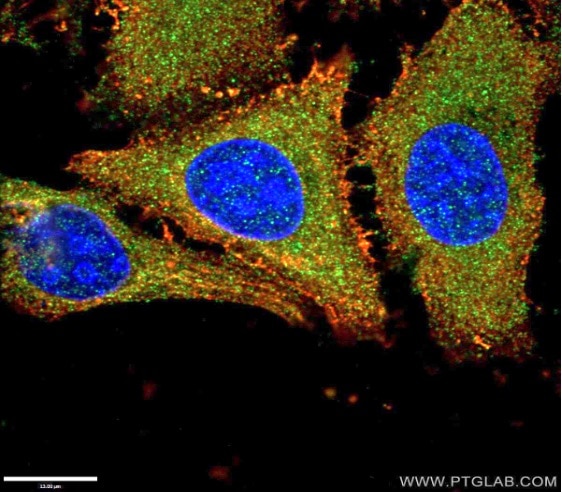 organelle markers recycling endosome markers