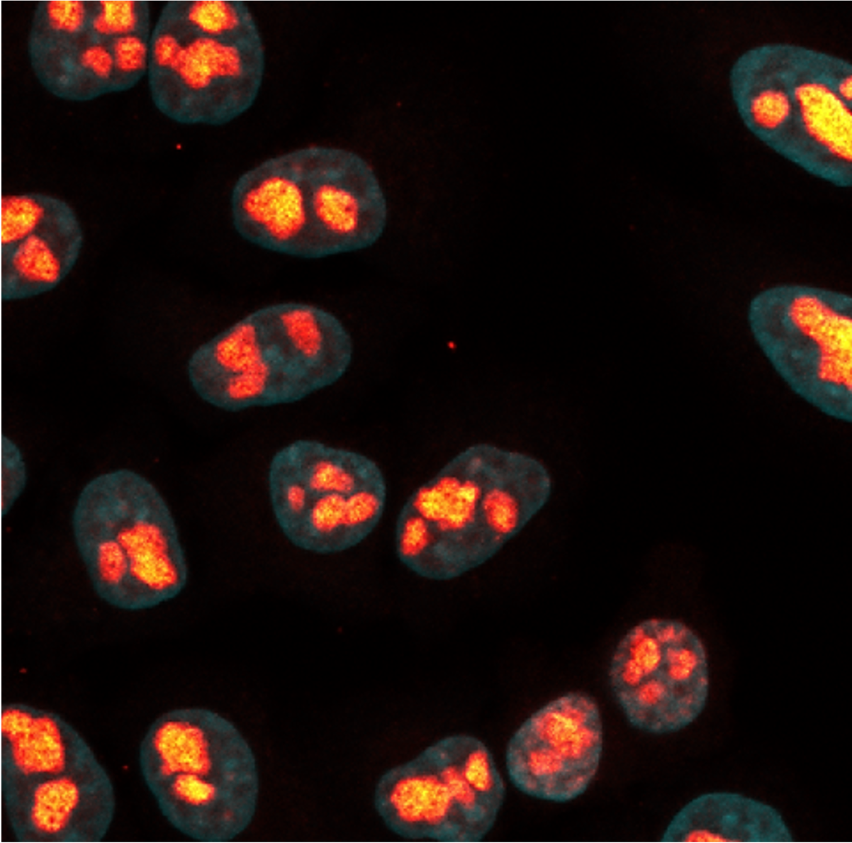 Immunostaining of HeLa cells with mouse anti-B23 antibodies (60096-1-Ig, 1:100, orange), on-bead chemically conjugated to a 15-nt ssDNA oligo, purified using CleanAB beads and desalted. Detection was performed by hybridization with an imaging DNA strand labeled with ATTO643.