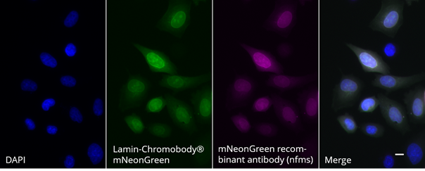 HeLa cells transiently expressing Lamin-Chromobody®-mNeonGreen were immunostained with mNeonGreen recombinant antibody, VHH-mouse IgG1 Fc fusion [CTK0203] (nfms-20, 1:500) and Nano-Secondary® alpaca anti-mouse IgG1, recombinant VHH, Alexa Fluor® 647 [CTK0103, CTK0104] (sms1AF647-1, 1:500). Scale bar, 10 μm.