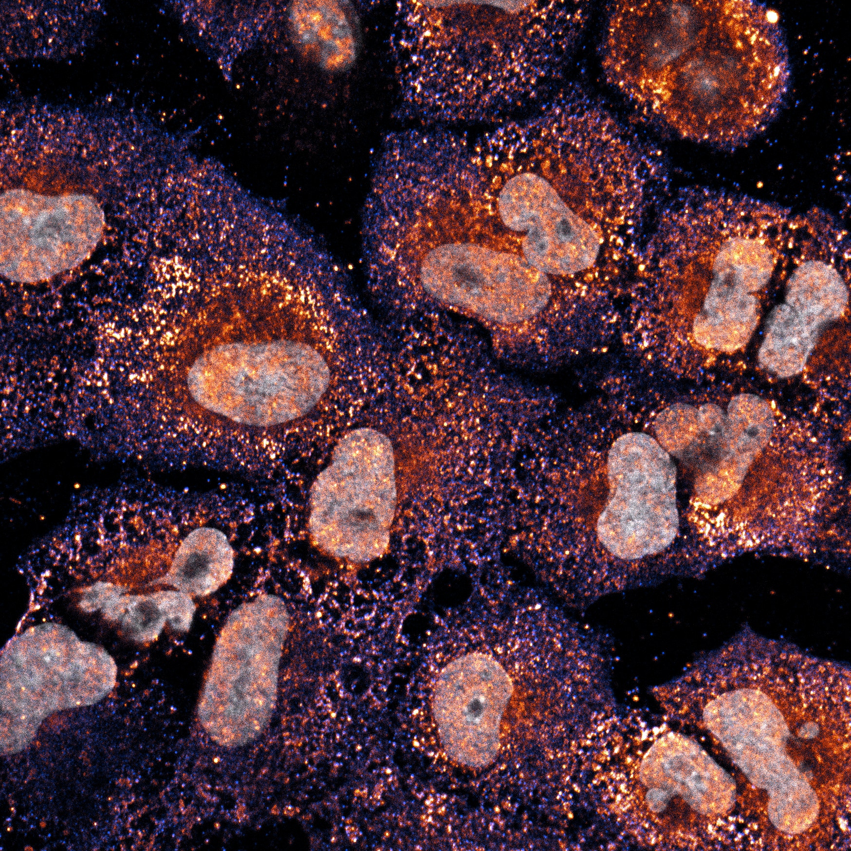This image displays a microscopic close-up of cells highlighting their internal structure. It features orange and gray hues that emphasize the contrast between different cellular components. The texture and coloration suggest detailed biological imaging.