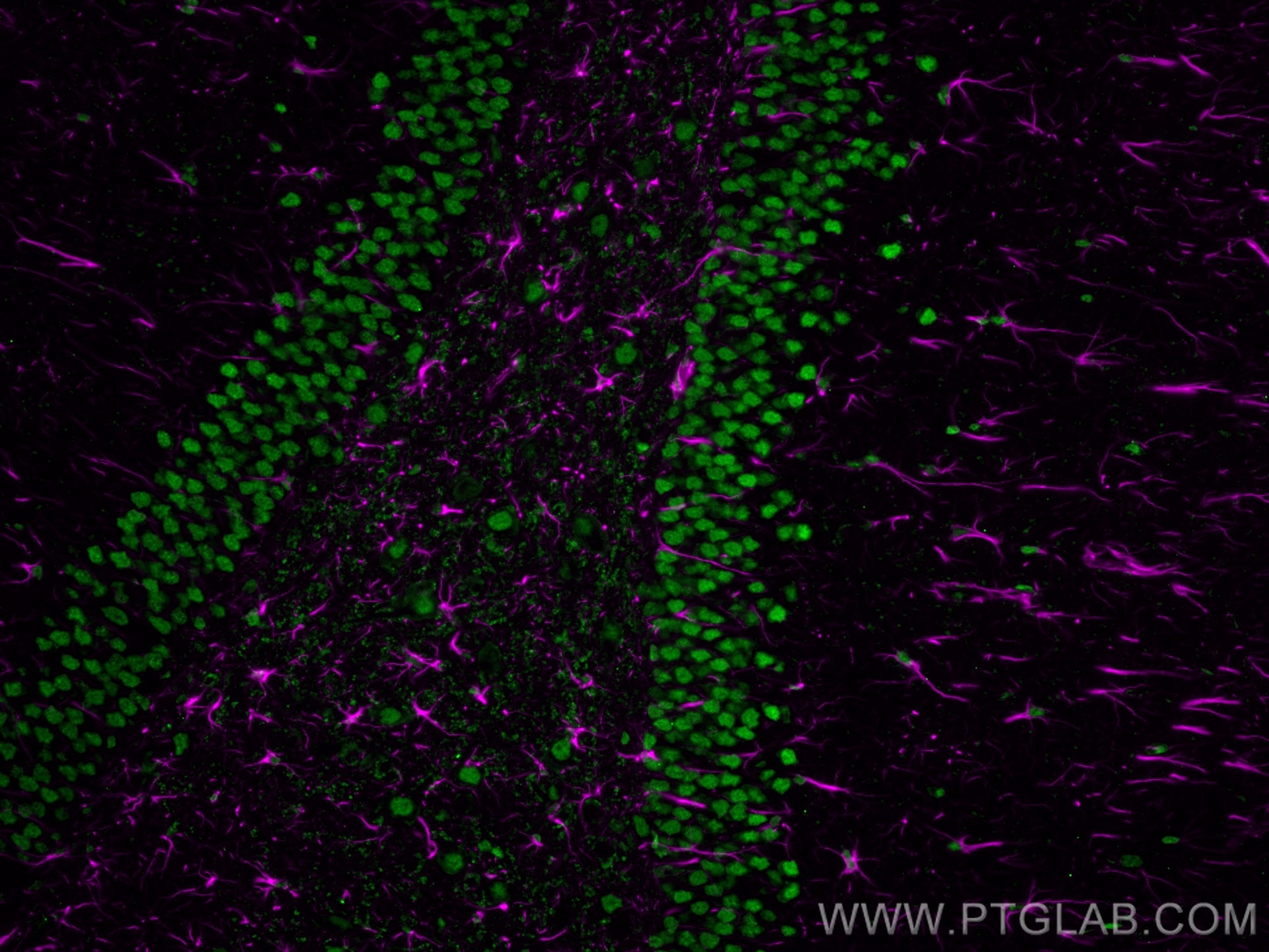 Immunofluorescence (IF) analysis of rat brain FFPE section stained with rabbit anti-GFAP polyclonal antibody (16825-1-AP, magenta) and mouse anti-NeuN monoclonal antibody (66836-1-Ig, green). Multi-rAb CoraLite® Plus 647-Goat Anti-rabbit Secondary Antibody (H+L) (RGAM005, 1:500) and Multi-rAb CoraLite® Plus 488-Goat Anti-Mouse Recombinant Secondary Antibody (H+L) were (RGAM002, 1:500) used for detection.  