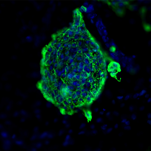 Cardiomyocyte derived from iPSCs characterized using Cardiac Troponin T Antibody and Nuclear stain DAPI (blue).
