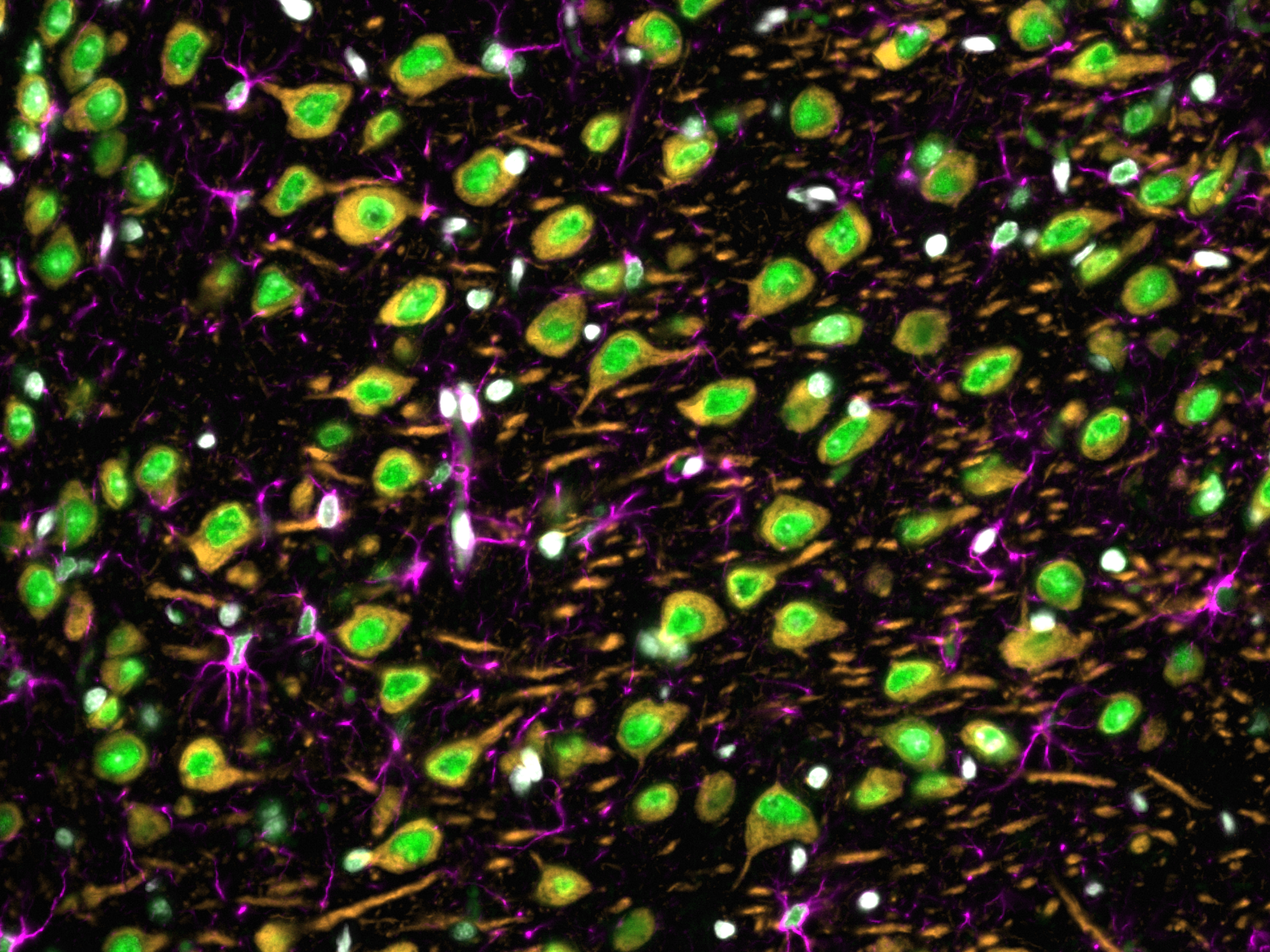 Immunofluorescence of rat brain tissue: FFPE rat brain tissue sections were stained with anti-MAP2 antibody (17490-1-AP) labeled with FlexAble CoraLite Plus 550 Kit (KFA002, orange), anti-GFAP antibody (16825-1-AP) labeled with FlexAble CoraLite Plus 650 Kit (KFA003, magenta) and CoraLite®488-conjugated TDP-43 antibody (CL488-10782, green).