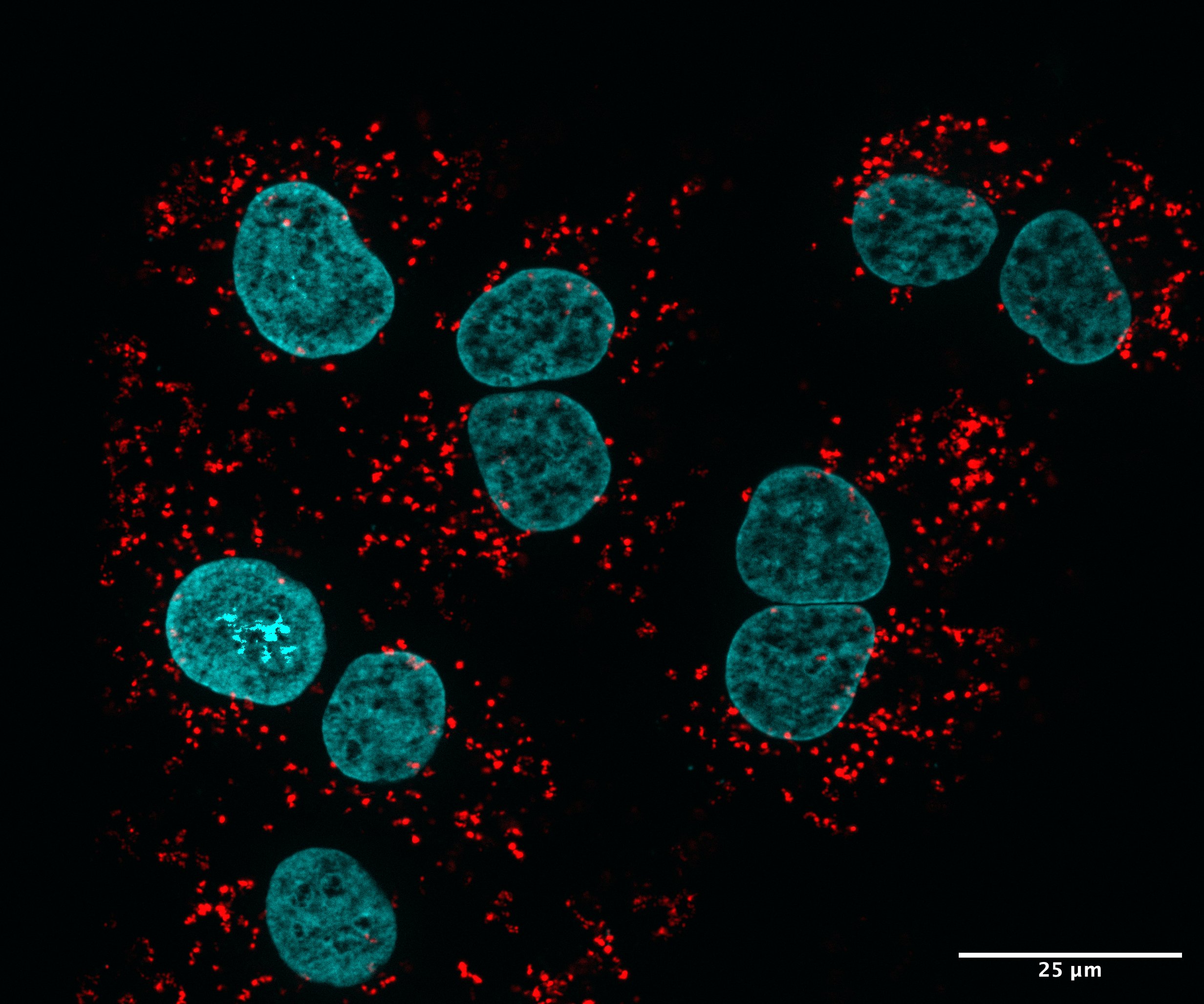 In situ PLA between VAPB and PTPIP51 in Huh7 cells to visualize the contacts between mitochondria and the endoplasmic reticulum.