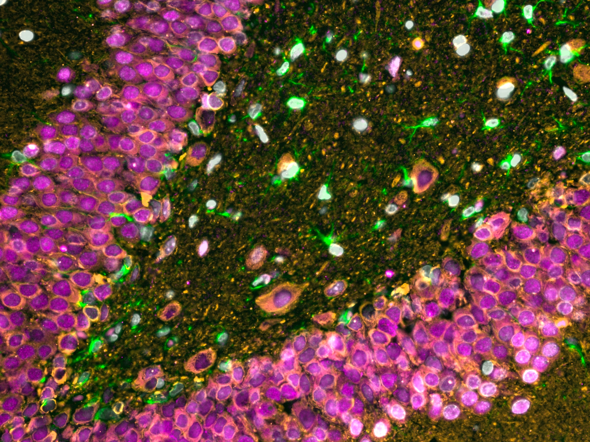 Immunofluorescence of rat brain tissue: FFPE rat brain tissue sections were stained with anti-NeuN antibody (66836-1-Ig) labeled with FlexAble CoraLite® Plus 647 Kit (KFA023, magenta), anti-TUBB3 antibody (66375-1-Ig) labeled with FlexAble CoraLite® Plus 555 Kit (KFA022, orange) and CoraLite®488-conjugated GFAP antibody (CL488-60190, green).