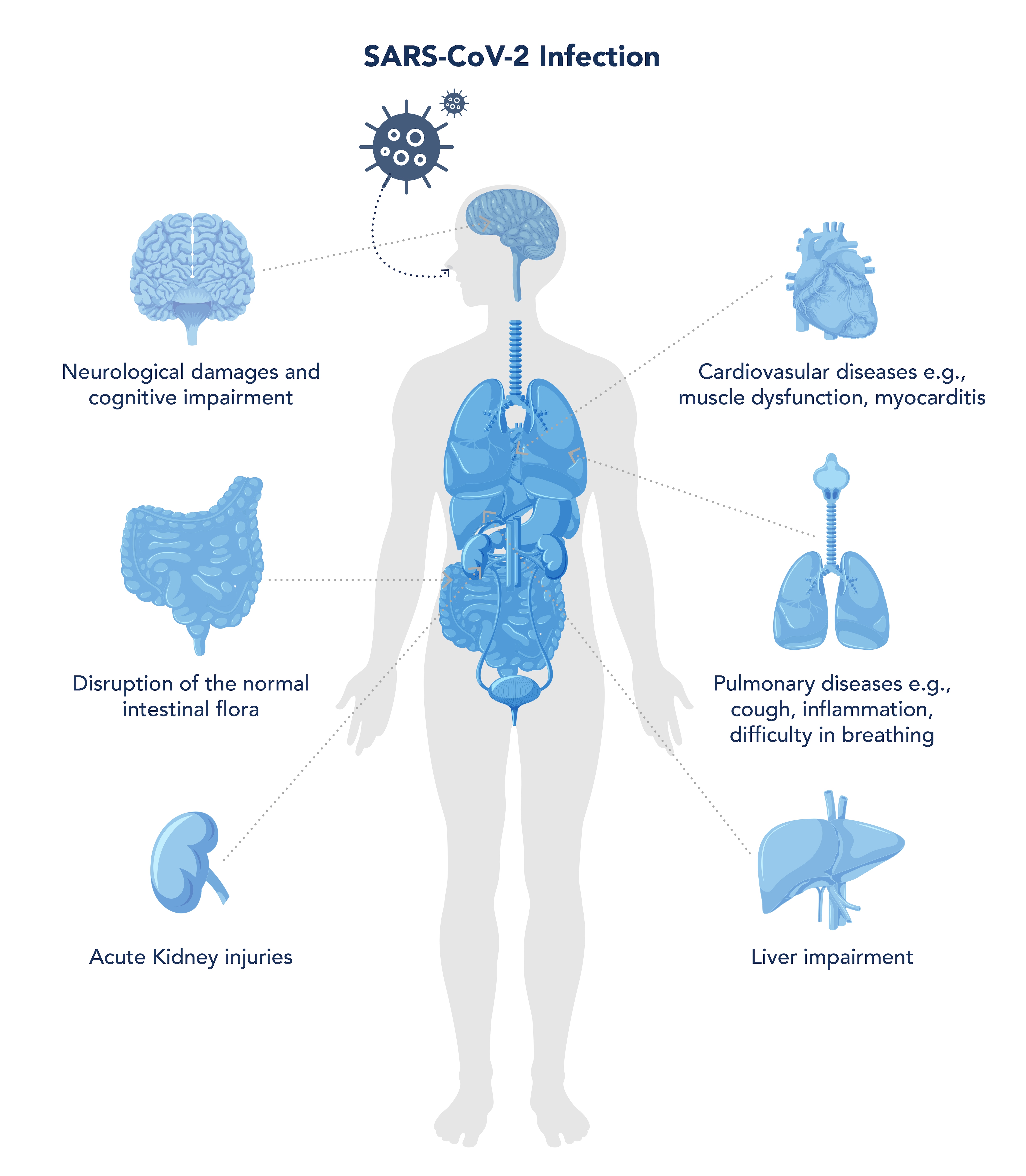 Graphic of the human body with highlighted organs detailing effects of COVID-19 infection.