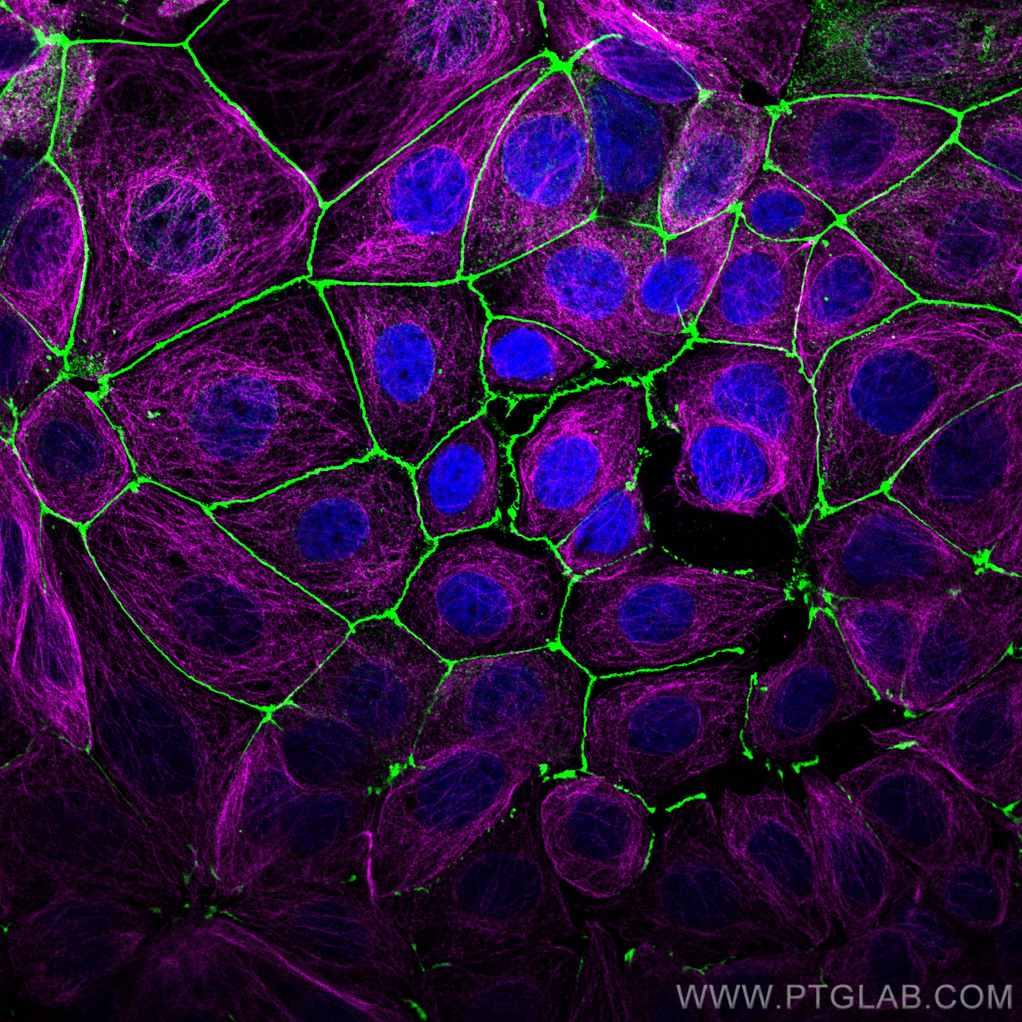 Immunofluorescence (IF) analysis of MCF-7 cells stained with rabbit anti-ZO1 polyclonal antibody (21773-1-AP, green) and mouse anti-Alpha Tubulin monoclonal antibody (66031-1-Ig, magenta). Multi-rAb CoraLite® Plus 488-Goat Anti-Rabbit Recombinant Secondary Antibody (H+L) (RGAR002, 1:500) and Multi-rAb CoraLite® Plus 647-Goat Anti-Mouse Recombinant Secondary Antibody (H+L)</a> (RGAM005, 1:500) were used for detection.  