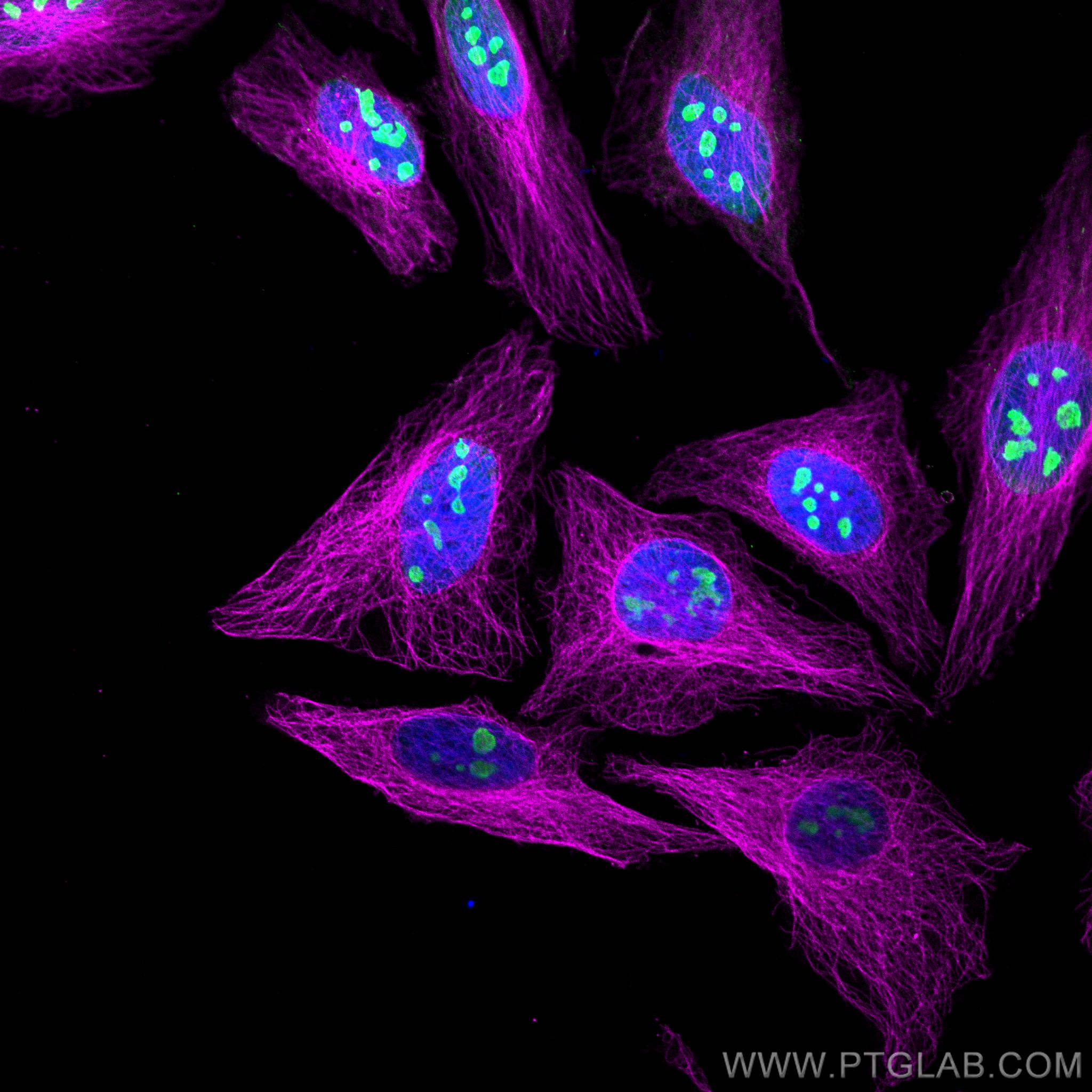 Immunofluorescence (IF) analysis of Hela cells stained with rabbit anti-Alpha Tubulin polyclonal antibody (11224-1-AP, magenta) and mouse anti-NPM1 monoclonal antibody (60096-1-Ig, green). Multi-rAb CoraLite® Plus 647-Goat Anti-Rabbit Recombinant Secondary Antibody (H+L) (RGAR005, 1:500) and Multi-rAb CoraLite® Plus 488-Goat Anti-Mouse Recombinant Secondary Antibody (H+L) (RGAM002, 1:500) were used for detection.