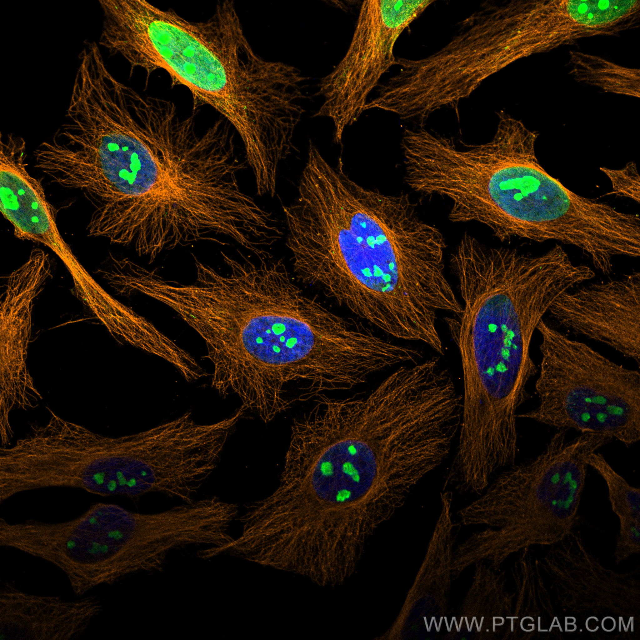 Immunofluorescence (IF) analysis of Hela cells stained with rabbit anti-Alpha Tubulin polyclonal antibody (11224-1-AP, orange) and mouse anti-NPM1 monoclonal antibody (60096-1-Ig, green). Multi-rAb CoraLite® Plus 555-Goat Anti-Rabbit Recombinant Secondary Antibody (H+L) (RGAR003, 1:500) and Multi-rAb CoraLite® Plus 488-Goat Anti-Mouse Recombinant Secondary Antibody (H+L) (RGAM002, 1:500) were used for detection.