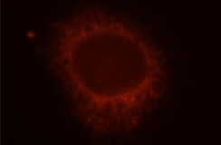Red fluorescence microscopy image showing a bright circular ring on a dark background