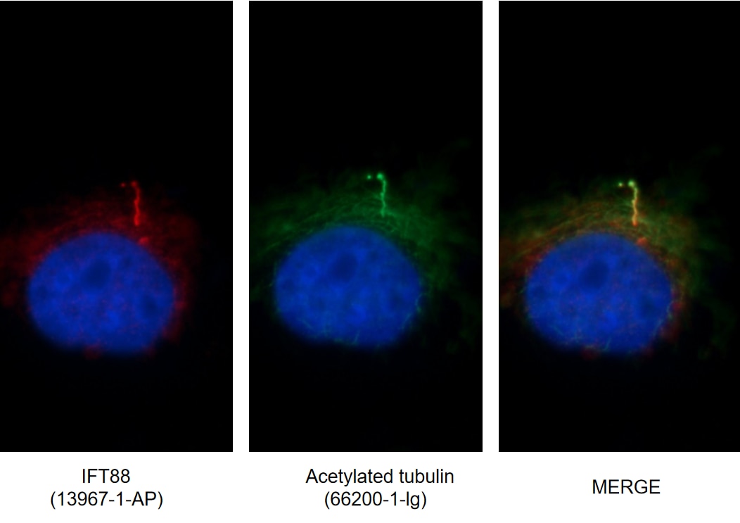 IF images of MDCK cells stained for IFT88 rabbit pAb (13967-1-AP) and acetylated tubulin mouse mAb (66200-1-Ig) at dilution of 1:50, further stained with Alexa Fluor 594-conjugated AffiniPure Goat Anti-Rabbit IgG (H+L) for 13967-1-AP, and Alexa Fluor 488-conjugated AffiniPure Goat anti-Mouse IgG (H+L) for 66200-1-Ig