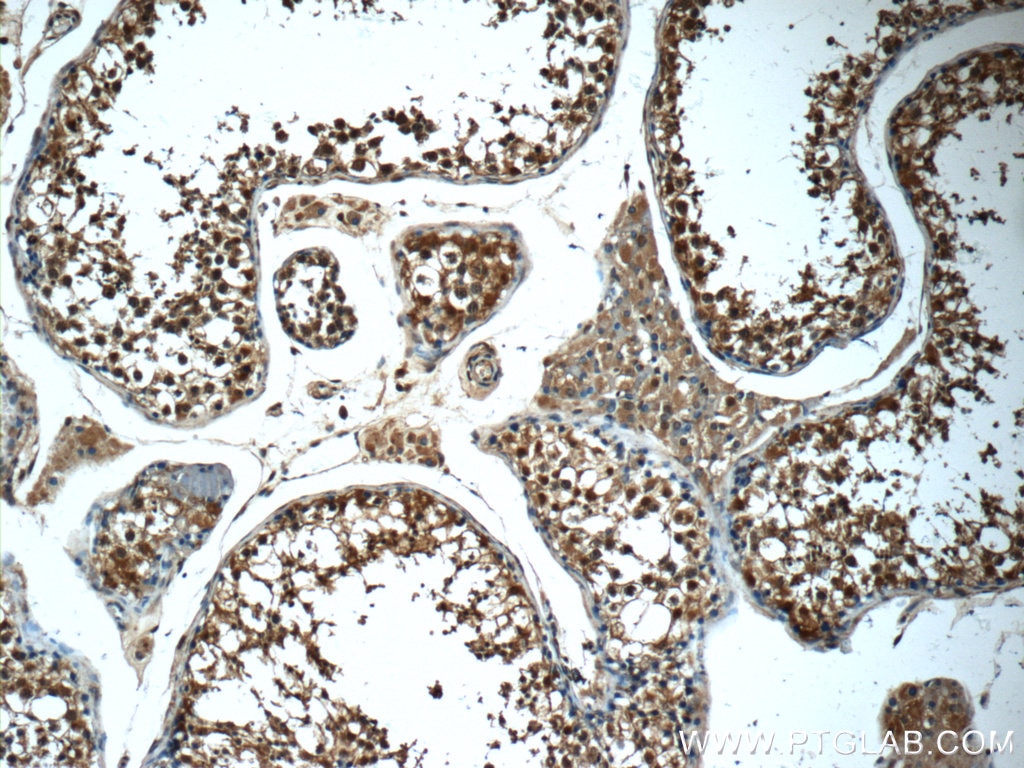Immunohistochemistry (IHC) staining of human testis tissue using 14-3-3 Polyclonal antibody (14503-1-AP)