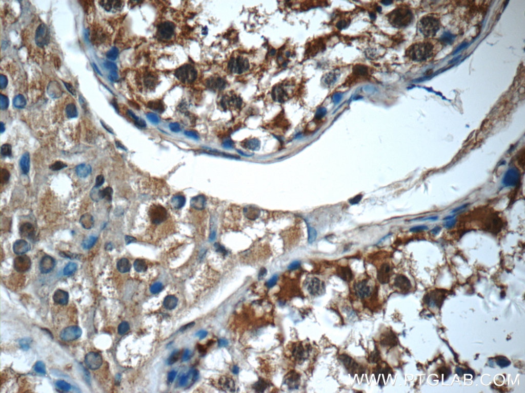 IHC staining of human testis using 14503-1-AP