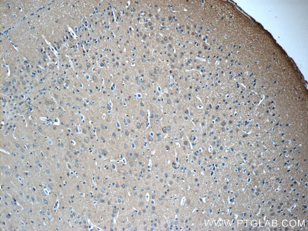 Immunohistochemistry (IHC) staining of mouse brain tissue using 14-3-3 Polyclonal antibody (14503-1-AP)