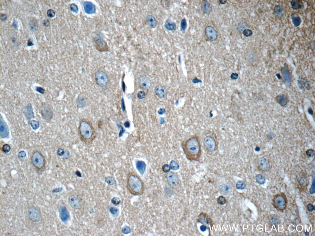 Immunohistochemistry (IHC) staining of mouse brain tissue using 14-3-3 Polyclonal antibody (14503-1-AP)