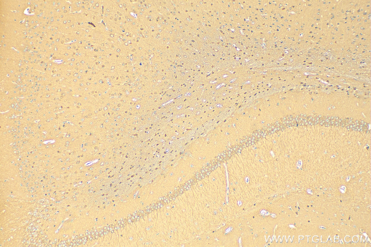 Immunohistochemistry (IHC) staining of mouse brain tissue using 14-3-3 Polyclonal antibody (14503-1-AP)