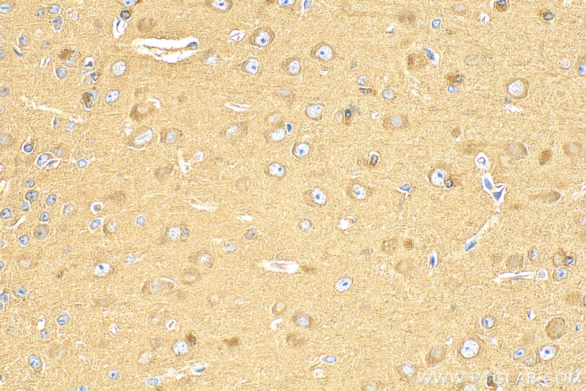 Immunohistochemistry (IHC) staining of mouse brain tissue using 14-3-3 Polyclonal antibody (14503-1-AP)