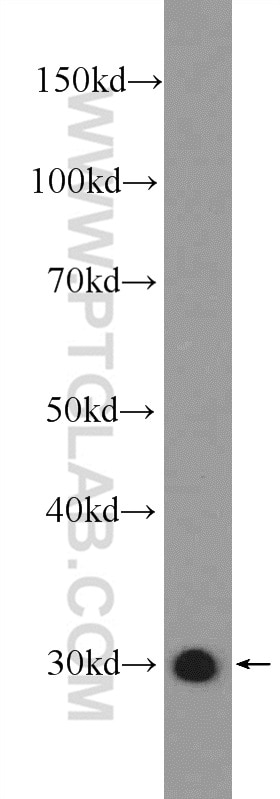 WB analysis of rat liver using 14503-1-AP