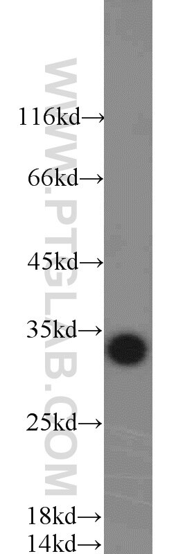 WB analysis of Jurkat using 14503-1-AP
