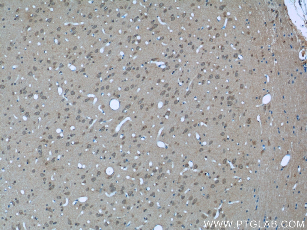 Immunohistochemistry (IHC) staining of rat brain tissue using 14-3-3 Monoclonal antibody (66061-1-Ig)