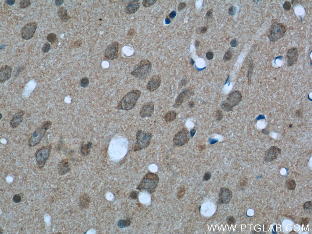 Immunohistochemistry (IHC) staining of rat brain tissue using 14-3-3 Monoclonal antibody (66061-1-Ig)