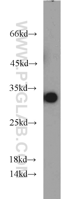 14-3-3 Monoclonal antibody