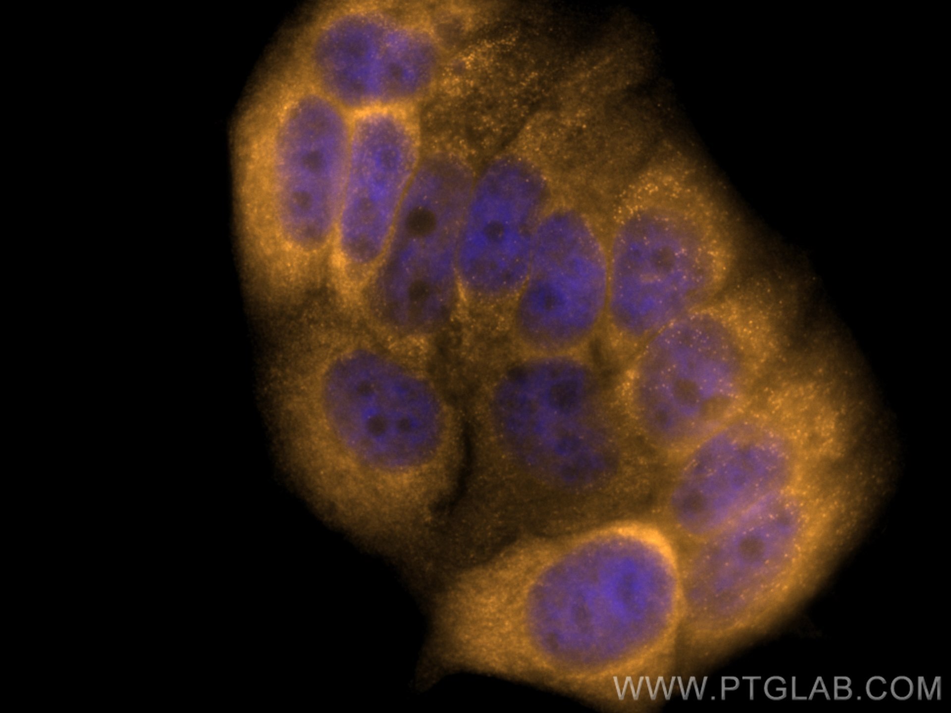 Immunofluorescence (IF) / fluorescent staining of MCF-7 cells using CoraLite®555-conjugated 14-3-3 Sigma Monoclonal an (CL555-66251)