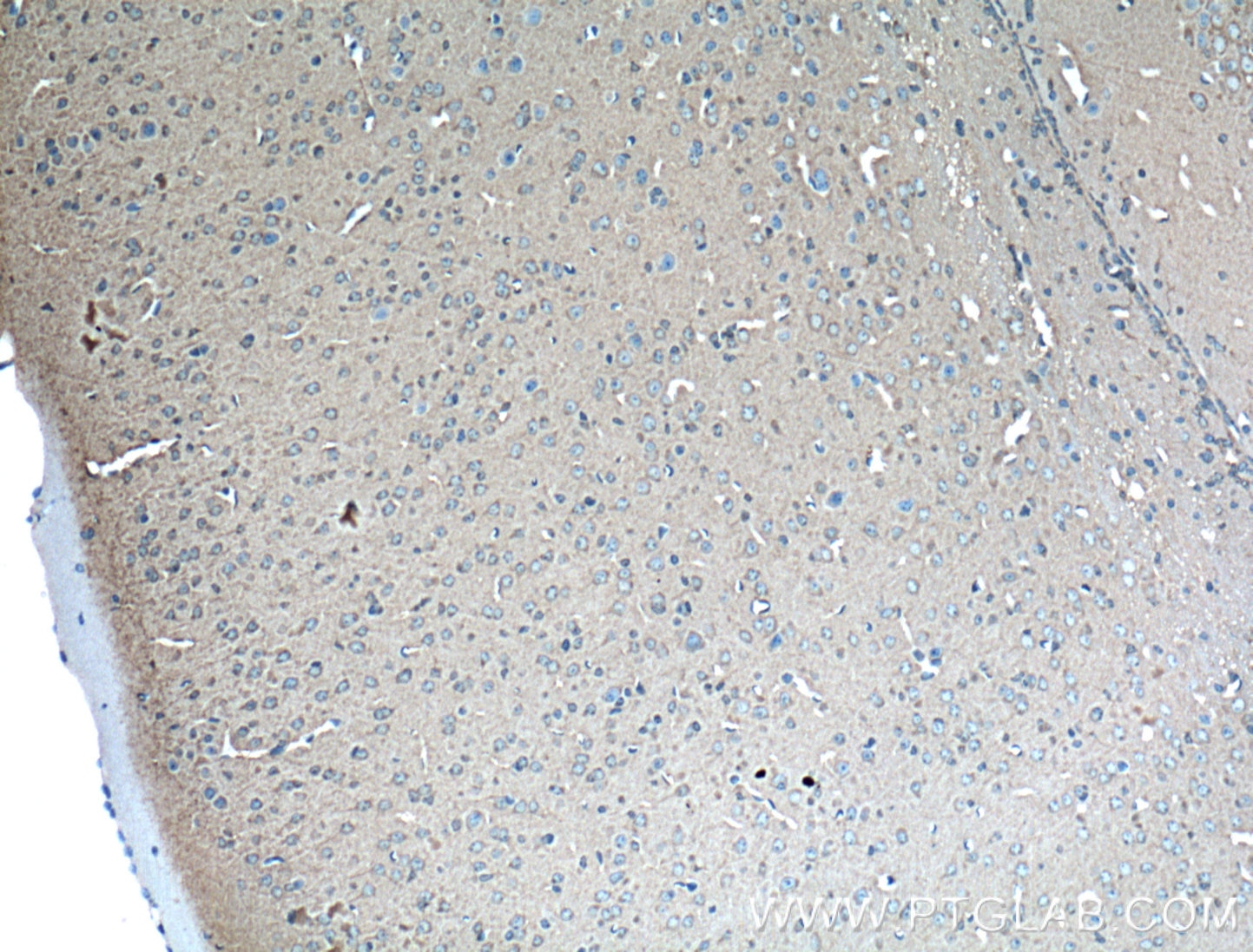 Immunohistochemistry (IHC) staining of mouse brain tissue using 14-3-3 Epsilon Polyclonal antibody (11648-2-AP)