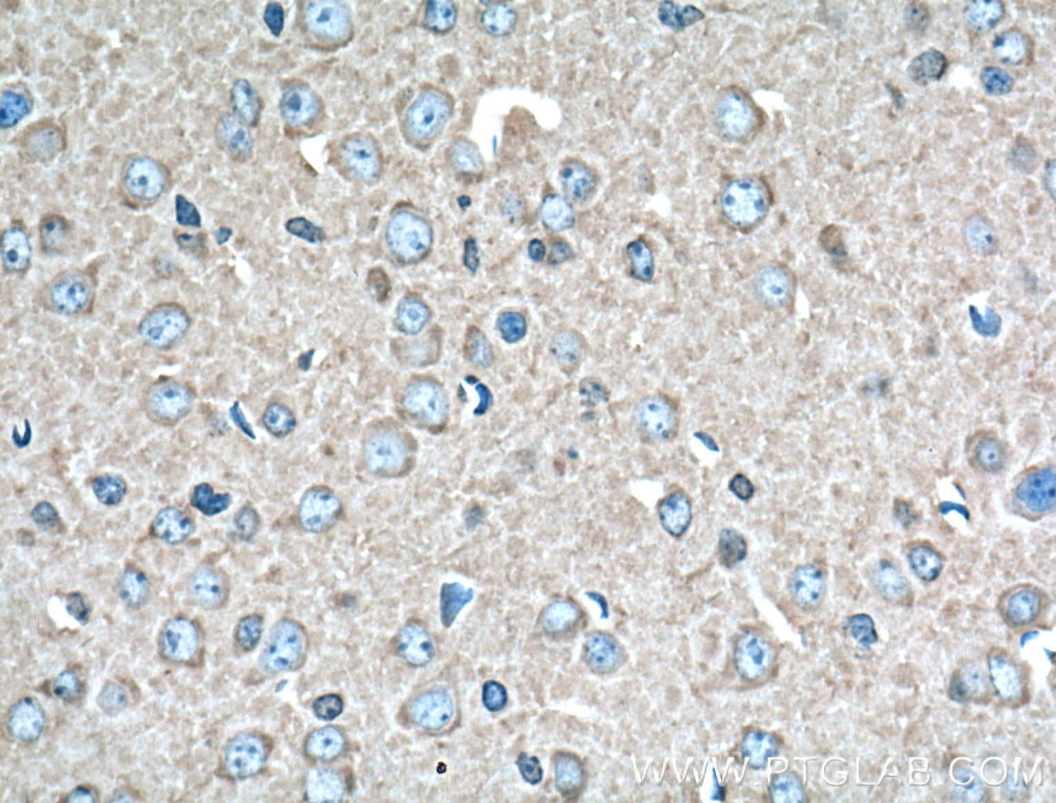 Immunohistochemistry (IHC) staining of mouse brain tissue using 14-3-3 Epsilon Polyclonal antibody (11648-2-AP)