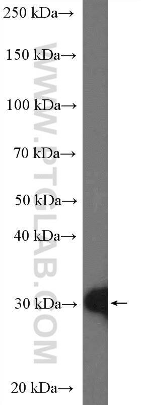 WB analysis of HeLa using 11648-2-AP