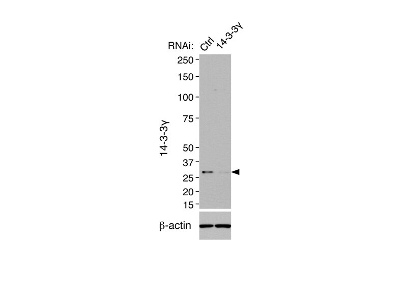 WB analysis of mouse IMCD3 cells (RNAi) using 12381-1-AP