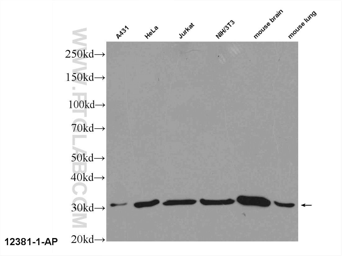 Western Blot (WB) analysis of A431 cells using 14-3-3 GAMMA-Specific Polyclonal antibody (12381-1-AP)
