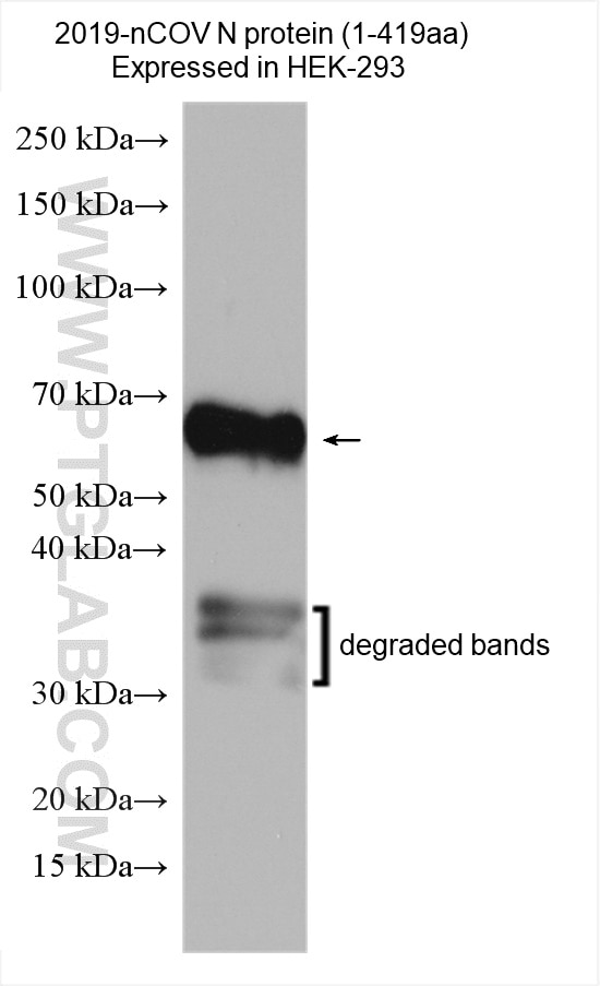 Western Blot (WB) analysis of various lysates using SARS-CoV-2 Nucleocapsid Phosphoprotein Polyclonal  (28769-1-AP)