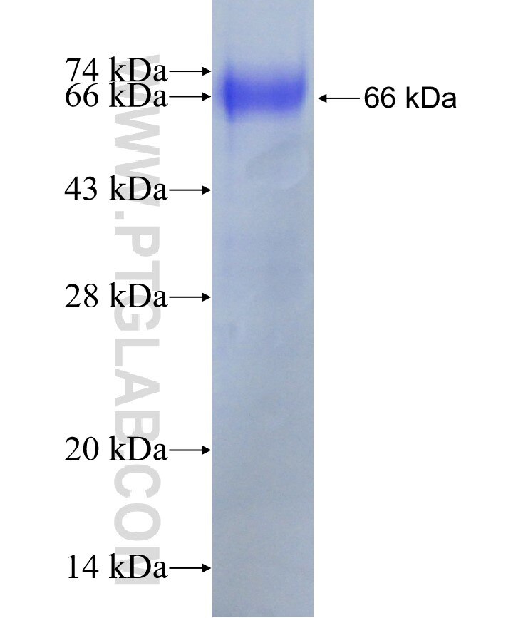 2019-nCOV nucleocapsid phosphoprotein fusion protein Ag31125 SDS-PAGE