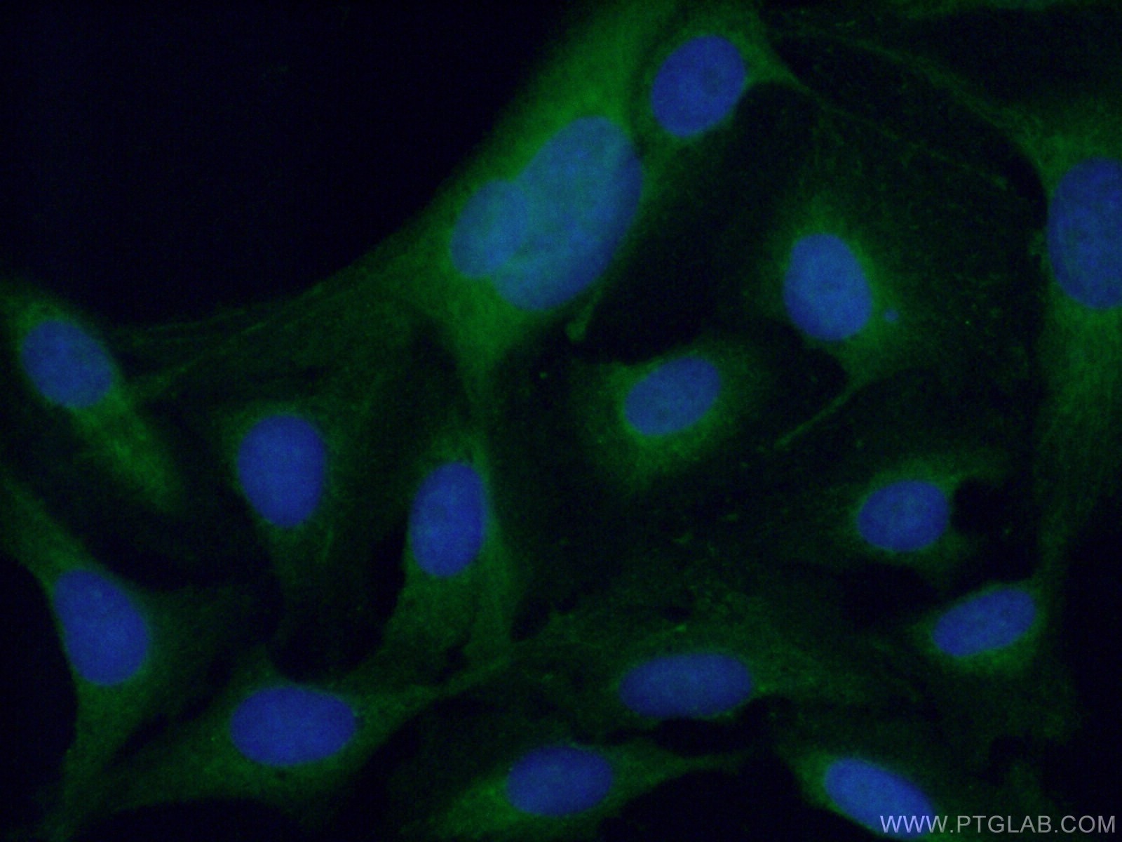 Immunofluorescence (IF) / fluorescent staining of U2OS cells using PPP3CC-specific Polyclonal antibody (55163-1-AP)