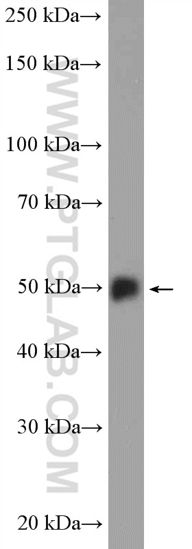 Western Blot (WB) analysis of fetal human brain tissue using PPP3CC-specific Polyclonal antibody (55163-1-AP)