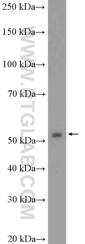 Western Blot (WB) analysis of human testis tissue using PPP3CC-specific Polyclonal antibody (55163-1-AP)