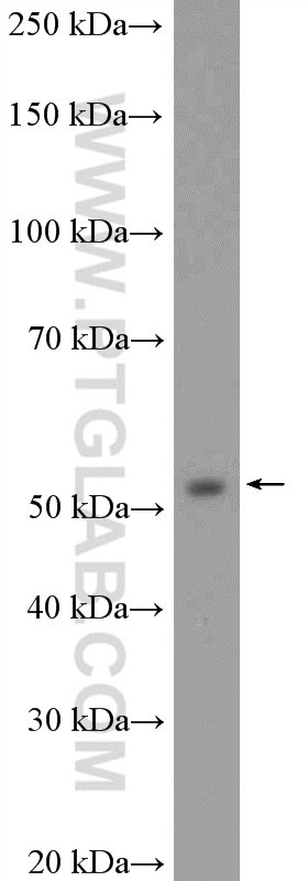 Western Blot (WB) analysis of human testis tissue using PPP3CC-specific Polyclonal antibody (55163-1-AP)