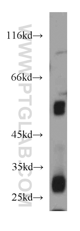 Western Blot (WB) analysis of human brain tissue using PPP3CC-specific Polyclonal antibody (55163-1-AP)