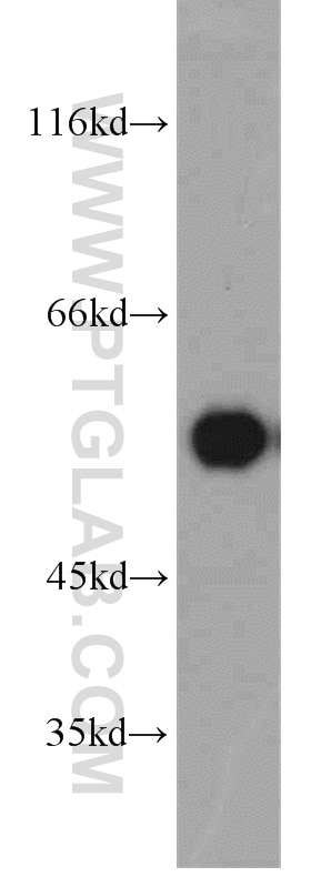 Western Blot (WB) analysis of human brain tissue using PPP3CC-specific Polyclonal antibody (55163-1-AP)